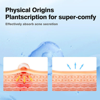 QUSTERE -  Pimple Patches Acne Rescue