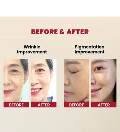 KSECRET - SEOUL 1988 Serum : Retinal Liposome 2% + Black Ginseng 30ml